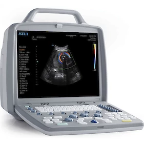 Prenosni ultrazvok tudi v Črnomelj in Metliko