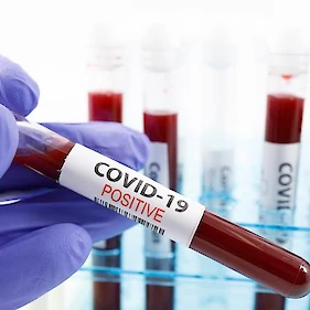 Število potrjenih okužb s koronavirusom v Sloveniji preseglo 200