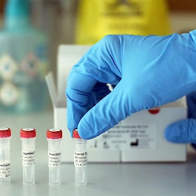 V Sloveniji potrdili 253 okužb s koronavirusom