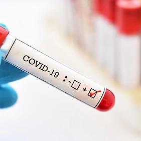 V Sloveniji že več kot 300 okuženih s koronavirusom
