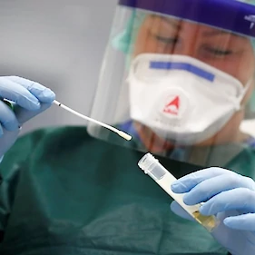 V Sloveniji že 414 okuženih z novim koronavirusom