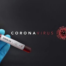 V Sloveniji zaradi koronavirusa zdaj že štirje mrtvi in 480 potrjenih okužb
