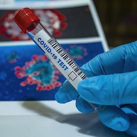 Včeraj ob 300 testiranjih potrdili štiri nove okužbe