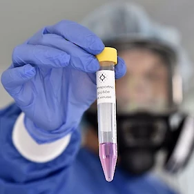 14 novih okužb s koronavirusom, umrl en bolnik
