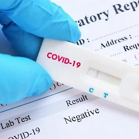 Včeraj potrdili 13 okužb z novim koronavirusom, umrl ni nihče