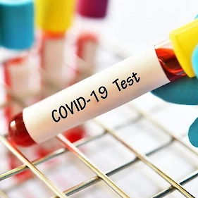 Včeraj opravljenih 2063 testov, potrjenih 464 okužb
