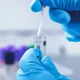 Včeraj izvedli 2611 PCR testov in odkrili 451 okužb