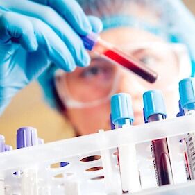 Včeraj ob 2620 opravljenih testih ugotovljenih 478 okužb z novim koronavirusom