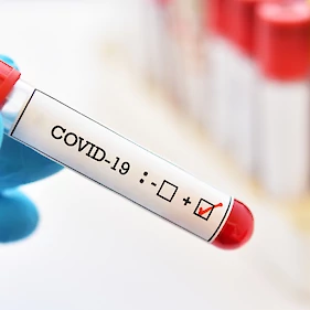 V Črnomlju en nov primer okužbe s koronavirusom