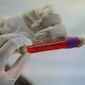 V Beli krajini včeraj potrdili 122 novih okužb